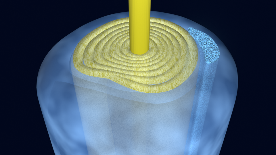 Still - Myelinisierung - Blender-Render (nativ)